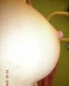 xxx-photo