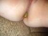 xxx-photo