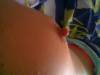 xxx-photo