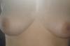 xxx-photo