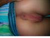 xxx-photo