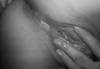 xxx-photo