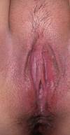 xxx-photo