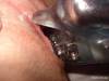 xxx-photo